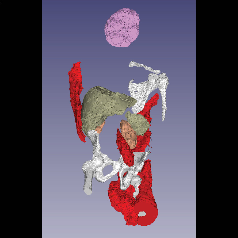 Full-Body-MRI-Segmentation